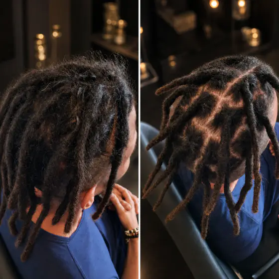 Before and after view of loc repair and root separation